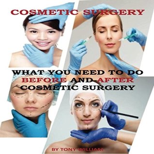 Read Cosmetic Surgery: What You Need To Do Before And After Cosmetic Surgery - Tony William | PDF