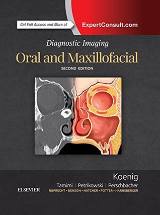 Read Diagnostic Imaging: Oral and Maxillofacial E-Book - Lisa J. Koenig | ePub